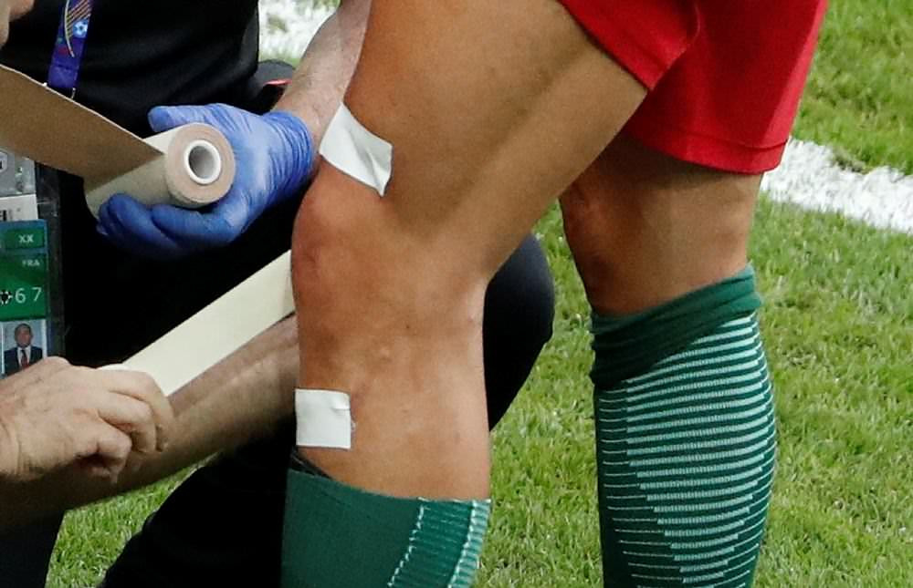 Ronaldo'nun gözyaşları! Finalde sakatlandı... - Resim: 2