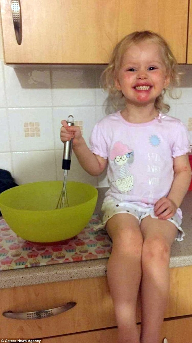 Dudağından öptükleri küçük kız, çaresiz bir hastalığa yakalandı - Resim: 2