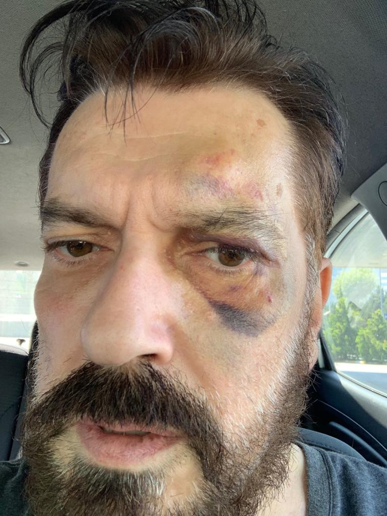 SONAR Araştırma Şirketi’nin sahibi Hakan Bayrakçı'ya saldırı - Resim: 1