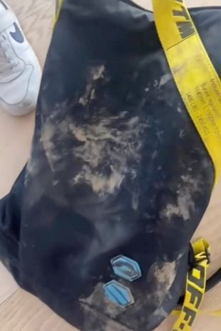 Shakira Yaban Domuzlarının Saldırısına Uğradı! - Resim: 1