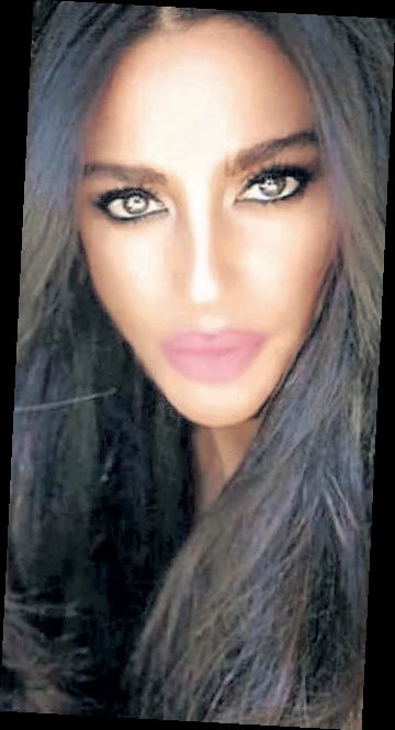 Aslıhan Doğan dudaklarına dolgu yaptırdı! - Resim: 2