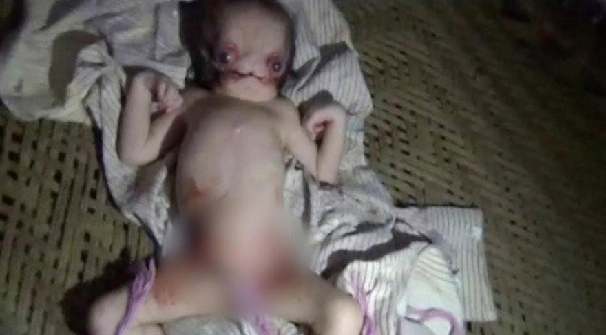 Şeytan görünümlü bebek görenleri ürküttü! Hastalığı ne? - Resim: 1