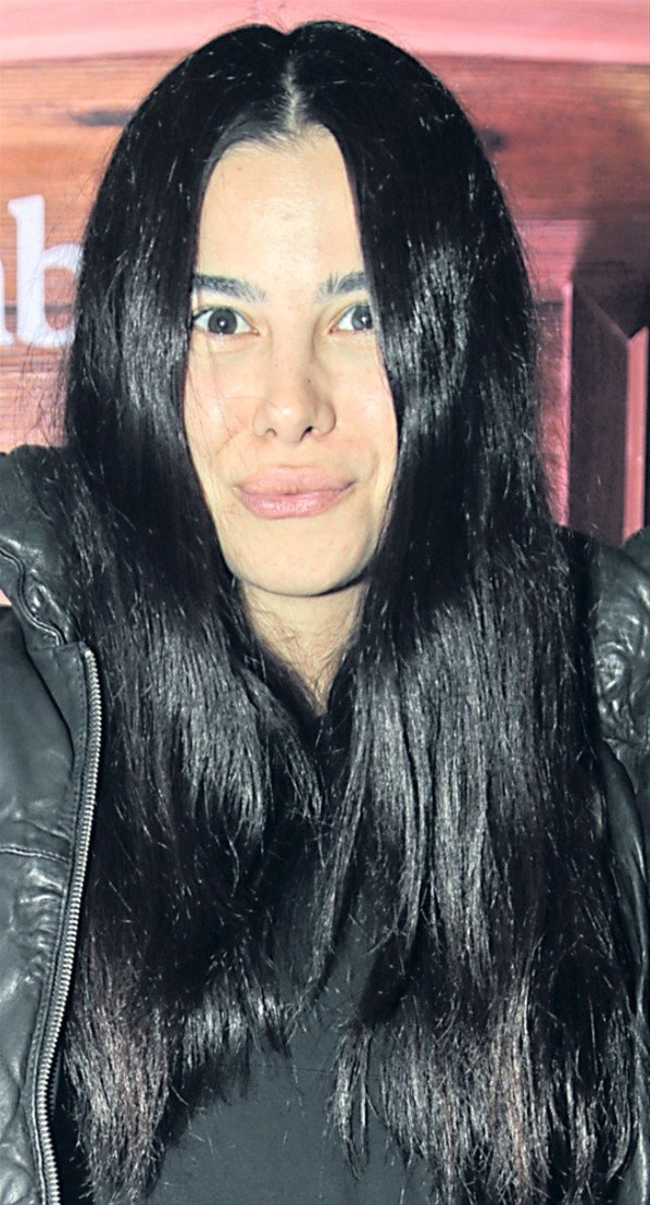 Asena Atalay dudaklarına silikonu fazla kaçırınca... Estetik faciası - Resim: 1