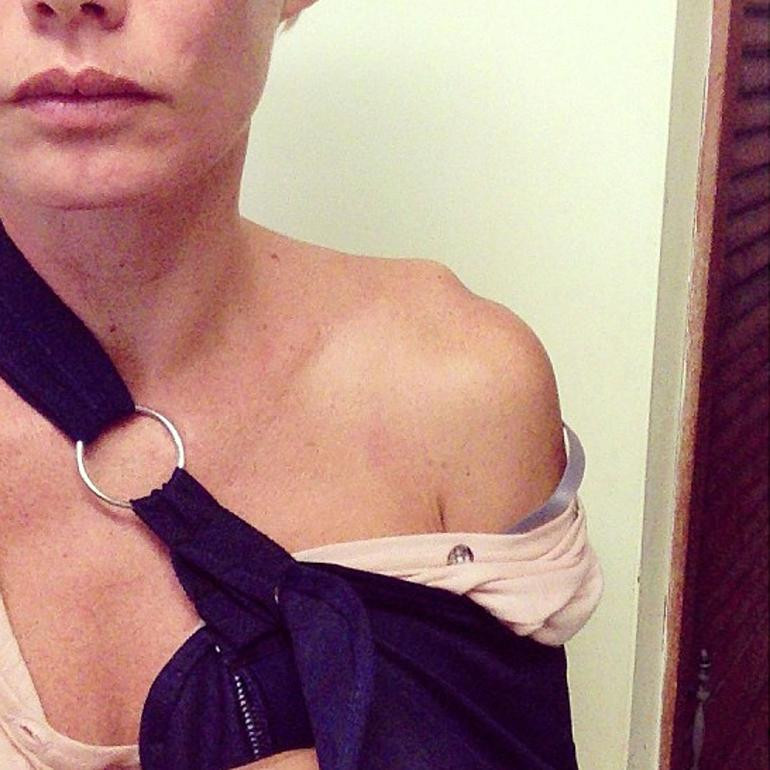 Star Wars'un dublörü kolunu kaybetti! - Resim: 1