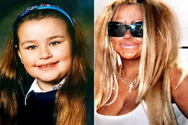 Karikatürüne benzemek için servet harcadı - Resim: 2