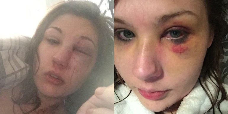 Sevgilisinden dayak yedi, annesinin ihanetiyle şoke oldu - Resim: 1