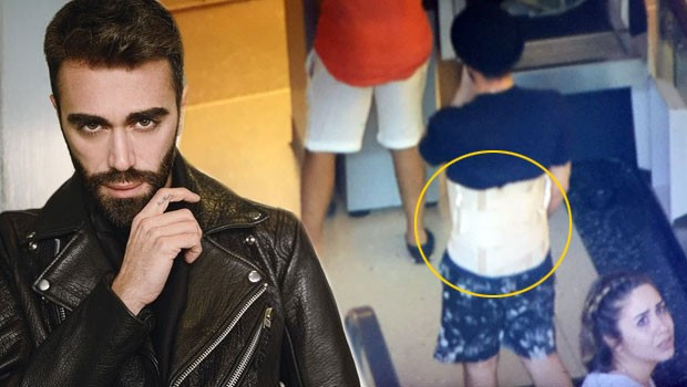 Kemal Doğulu çelik korse ile alışverişe çıktı - Resim: 1