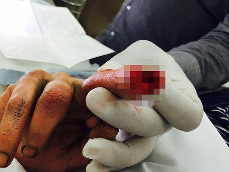 Amber Heard: Johnny Depp parmağını kesti ve kanıyla aynaya yazdı - Resim: 1