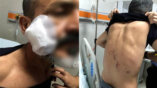 Polisin karısıyla yasak ilişki iş adamına pahalıya patladı - Resim: 1