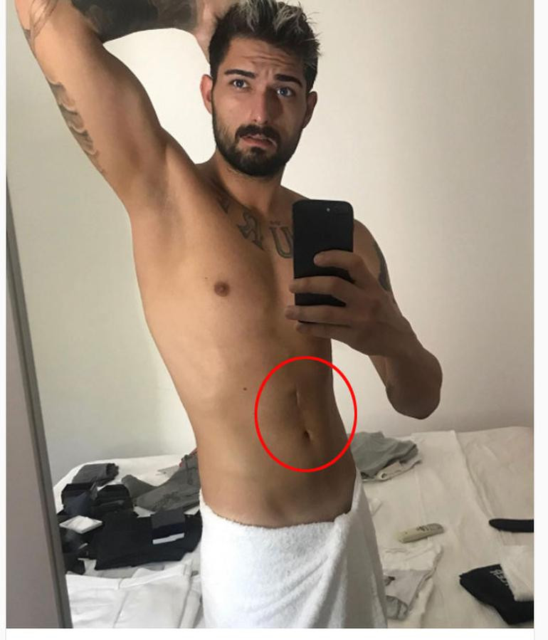 İdo Tatlıses, mide küçültme ameliyatı mı oldu? - Resim: 1