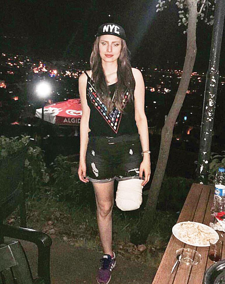 Ben bir bacaktan ibaret değilim ki... Çok daha fazlasıyım! - Resim: 1