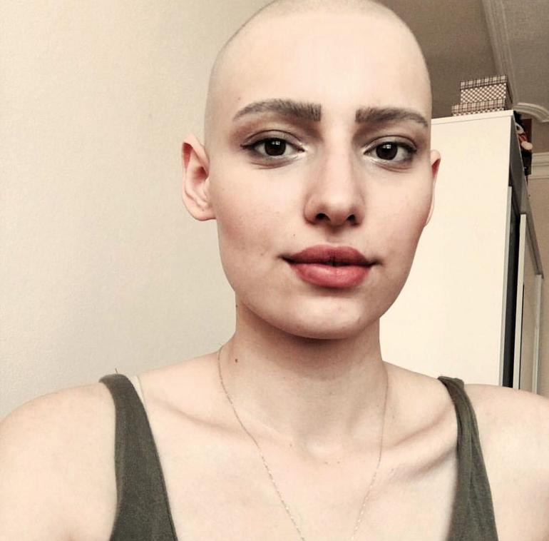 Ben bir bacaktan ibaret değilim ki... Çok daha fazlasıyım! - Resim: 3