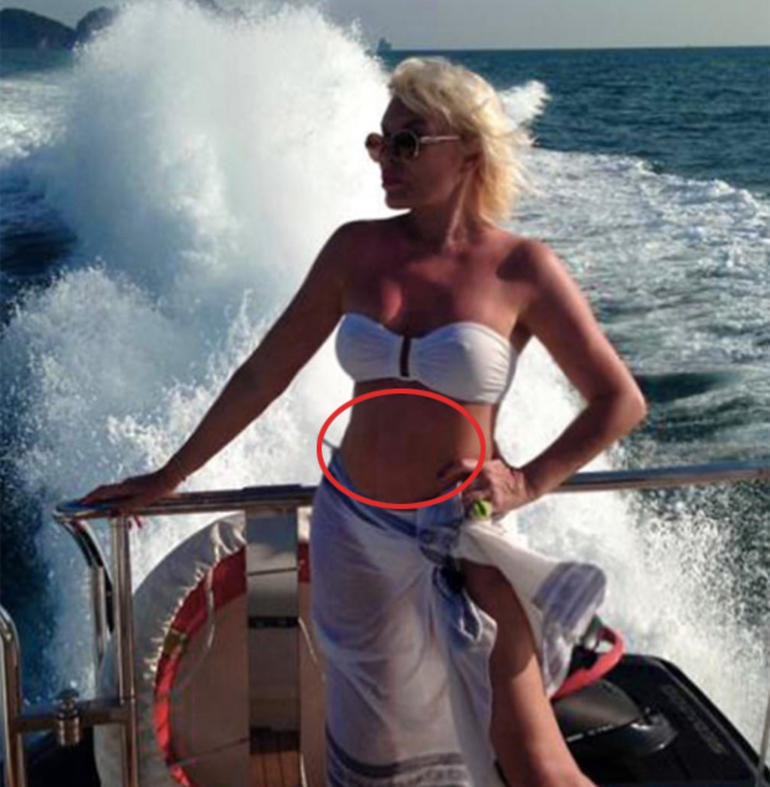 Ajda Pekkan'ın göbek deliği nereye kayboldu? - Resim: 1