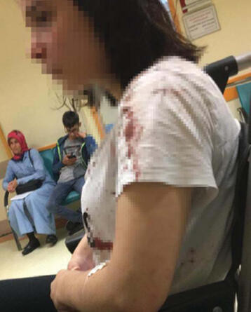 Rize'de tekme tokat saldırıya uğrayan Rabia ilk kez konuştu: Boğarak öldürecekti - Resim: 1