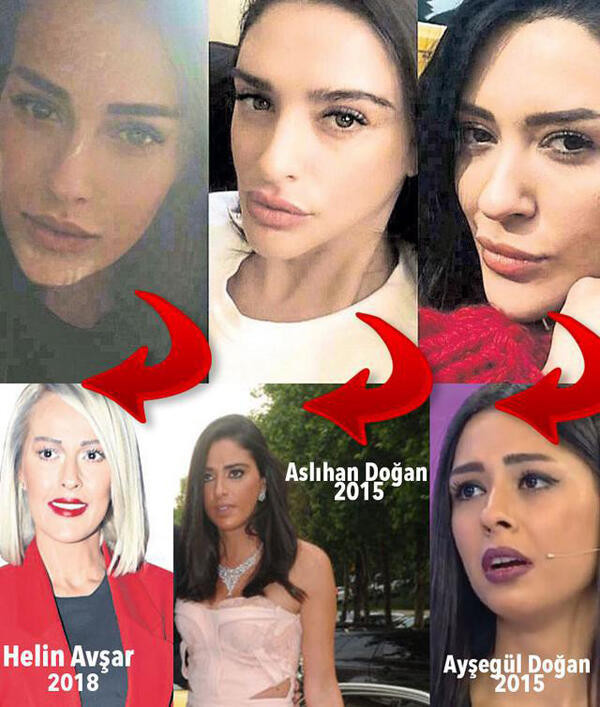 Instagram kızlarında son trend Aslıhan Doğan dudakları - Resim: 1