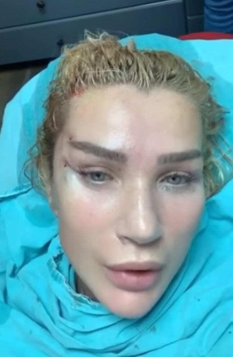 Seda Sayan'dan canlı canlı estetik operasyonu - Resim: 1