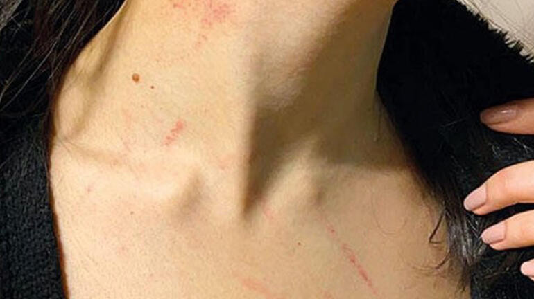 Lüks otelde firma sahibinden çalışanı genç kıza taciz - Resim: 1