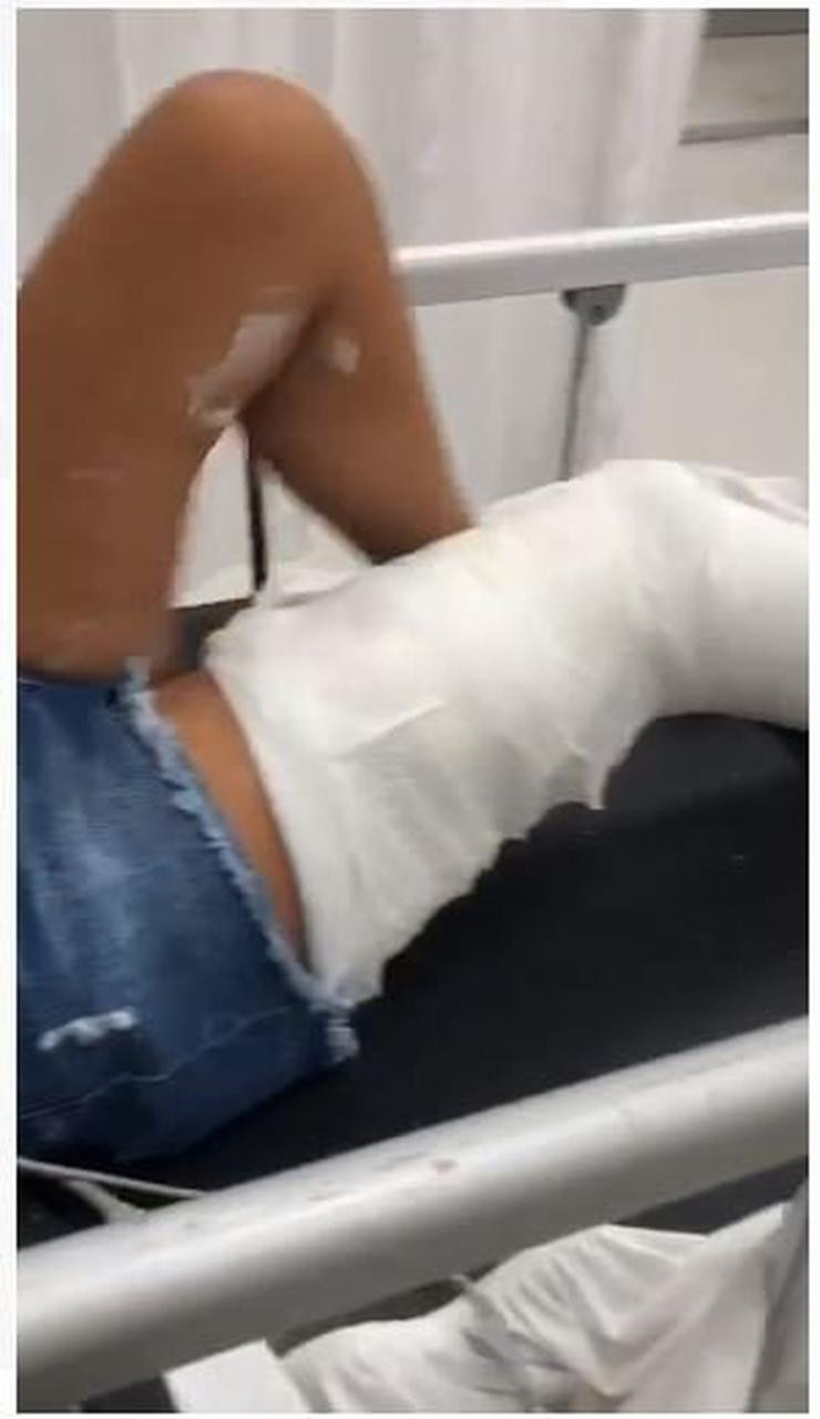 3 Çocuğunun Önünde Baldızının Bacağına Ateş Etti! - Resim: 1