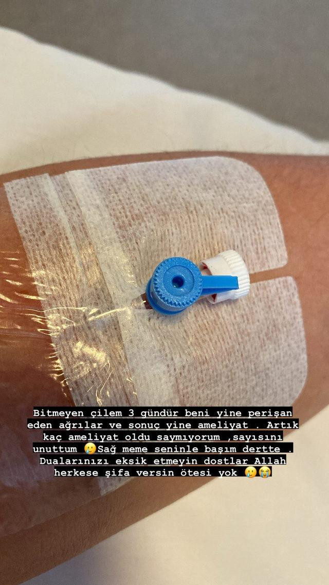 Fulden Uras Ameliyata Alındı: Fulden Uras'ın Hastalığı Ne? - Resim: 1