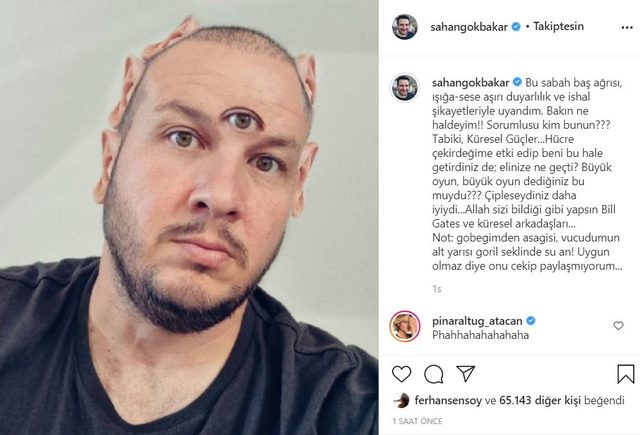 Şahan Gökbakar Aşı Karşıtı Erbakan'ın 5 Gözlü Yaratıklar Sözünü Ti'ye Aldı - Resim: 1