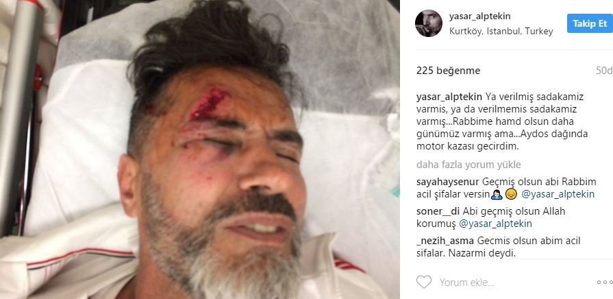 Bir anda kanlar içinde kaldı... Yaşar Alptekin ölümden döndü! - Resim: 1