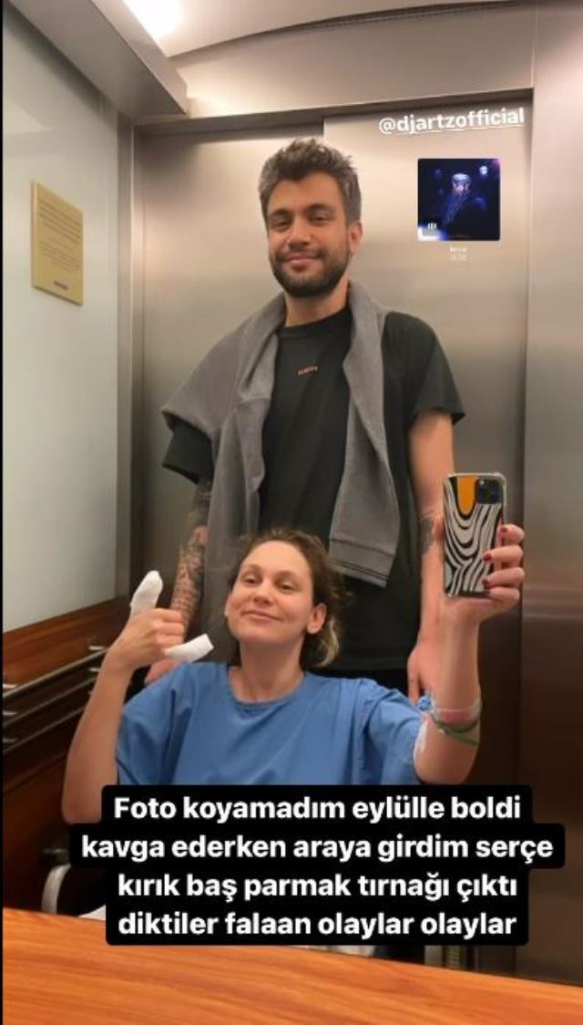 Farah Zeynep Abdullah Köpekleri Ayırmaya Çalışırken Hastanelik Oldu - Resim: 1