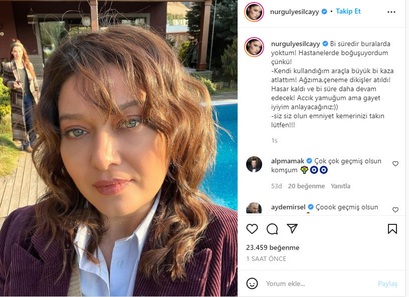 Nurgül Yeşilçay'dan Kötü Haber: Kaza Yaptım, Ağzıma ve Çeneme Dikiş Atıldı - Resim: 1