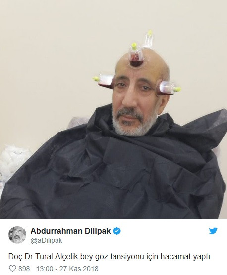 abdurrahman dilipak hacamat yaptirdi