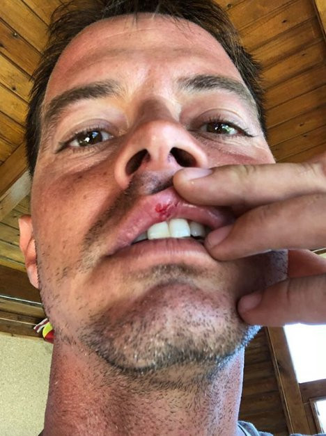 Alp Kırşan motor kazası geçirdi - Resim: 1