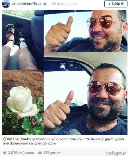 Ata Demirer motosiklet kazası geçirdi - Resim: 2