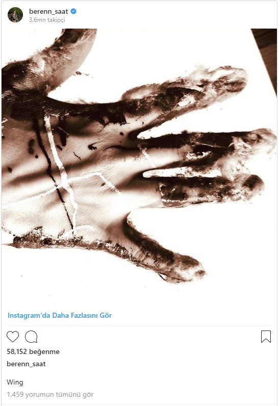 Beren Saat paylaştığı fotoğrafla hayranlarını tedirgin etti - Resim: 1