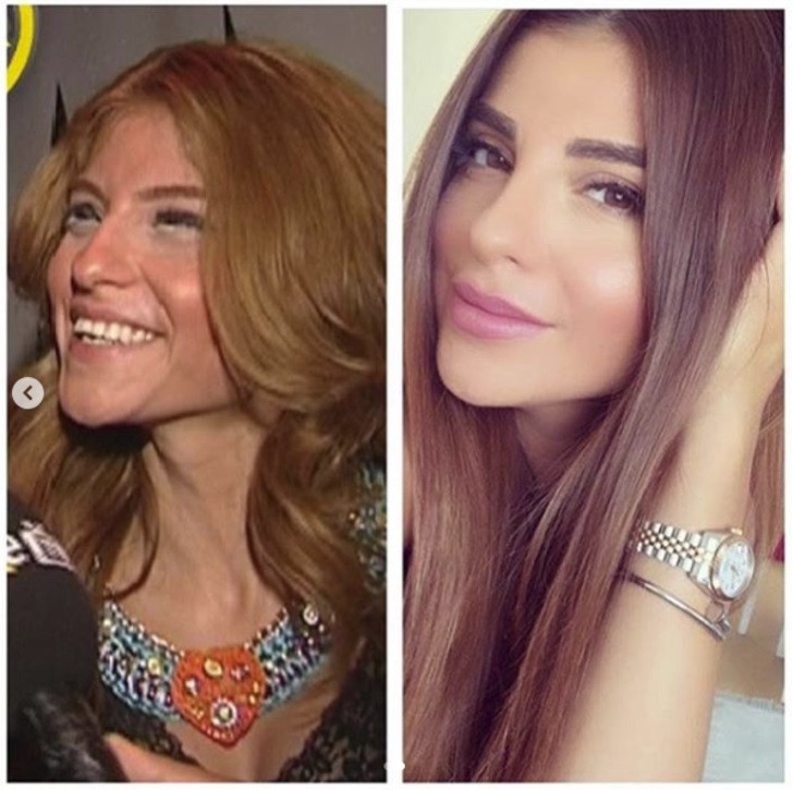 bircan bali nin estetiksiz hali saskina cevirdi medyafaresi com mobil