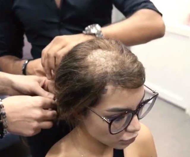 Buse Narcı'nın bu hali olay olmuştu! Gerçek ortaya çıktı - Resim: 1