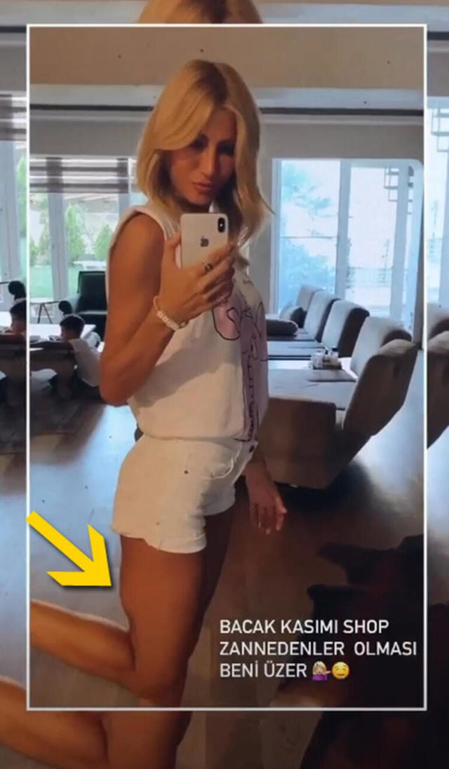 Çağla Şıkel bacağını gösterdi ve beni üzer dedi - Resim: 1