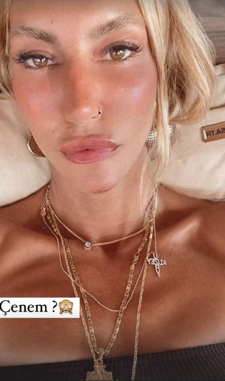 Çağla Şıkel'e Nazar Değdi! Spor Yaparken Kaza Geçirdi! - Resim: 1