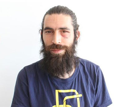 Vahşi dayağın kurbanı konuştu: Fransız değil Yozgatlıyım! - Resim: 1