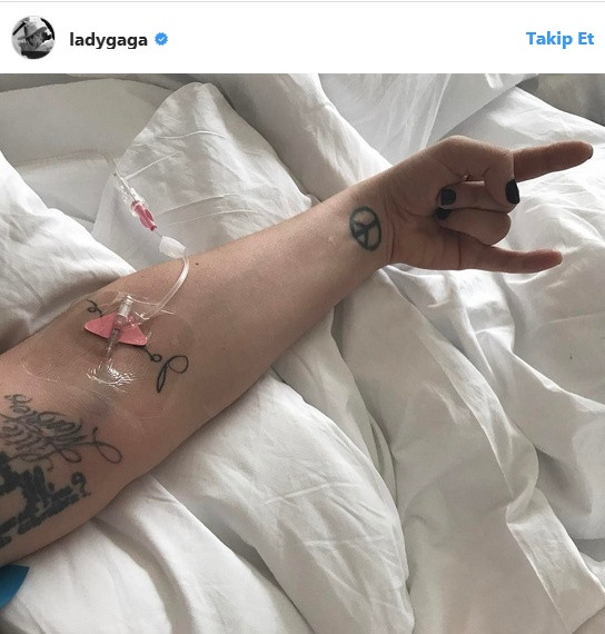 Lady Gaga'yı hastaneye düşüren gizemli hastalık hayranlarını şoke etti - Resim: 1
