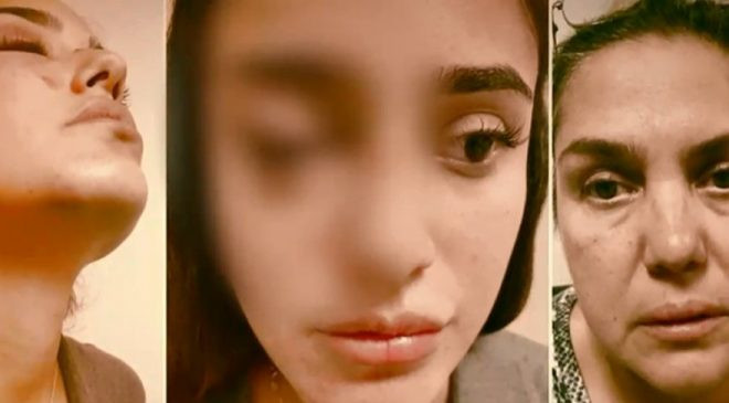 Sevgilisinden şiddet gören Ceren Kaplakarslan’ın son hali sevenlerini üzdü - Resim: 1