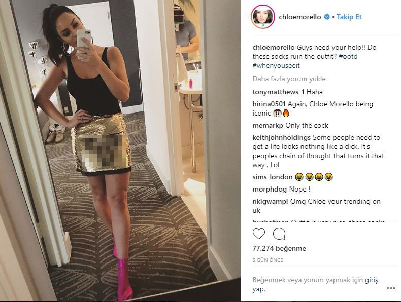 Chloe Morello‘nun çorap tavsiyesi almak için paylaştığı fotoğraf herkesi şoke etti - Resim: 1