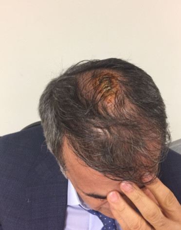 Sosyal medya ayakta! Şenol Güneş'in kafasına 5 dikiş - Resim: 1