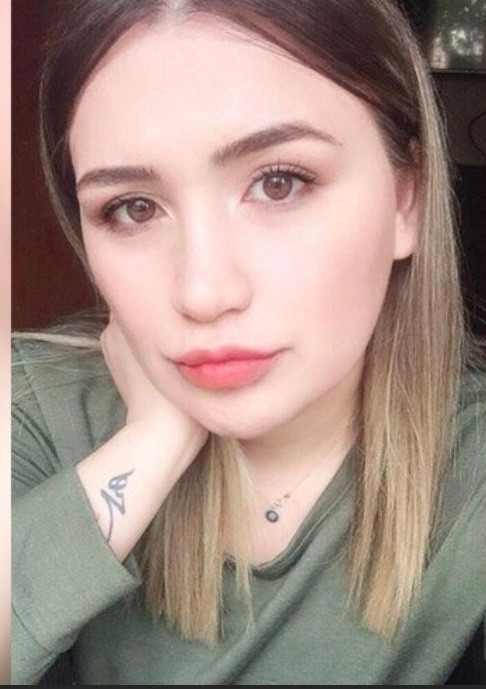 Silikonlu dudak mağduru hemşire Merve Keleş’in son hali - Resim: 1