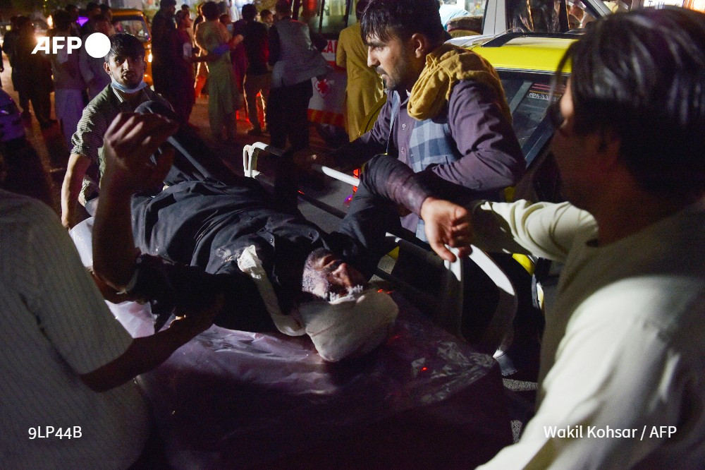 Kabil'deki Patlamalarda En Az 60 Kişi Hayatını Kaybetti - Resim: 3