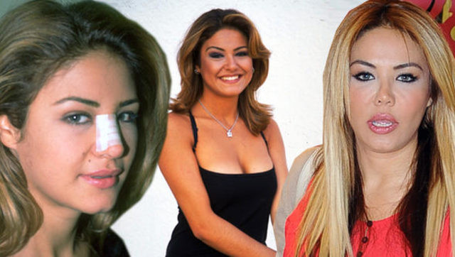 Esra Balamir'den yıllar sonra gelen estetik itirafı - Resim: 1