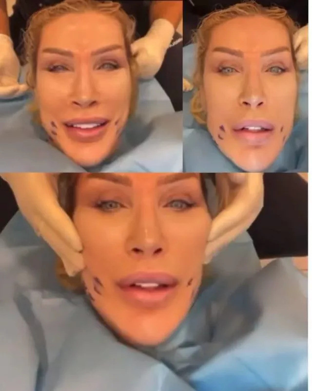 SEDA SAYAN 25 Yaş Genç Sevgilisi İçin Bir Estetik Daha Yaptırdı - Resim: 1