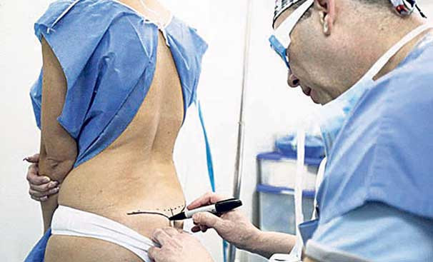 Popo estetiği ameliyatında merkez İstanbul oldu! - Resim: 1