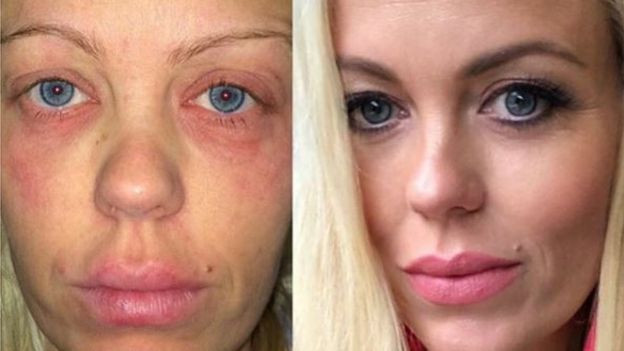 Avokado neden popüler oldu? Avokado'nun faydaları neler? - Resim: 1