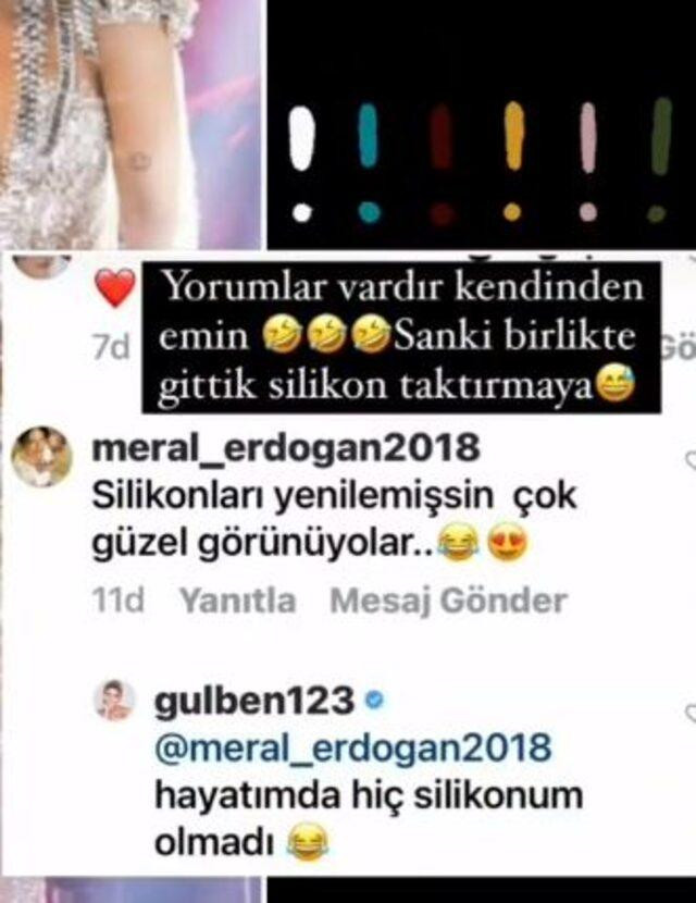 Gülben Ergen'den Dikkat Çeken Silikon Açıklaması - Resim: 1