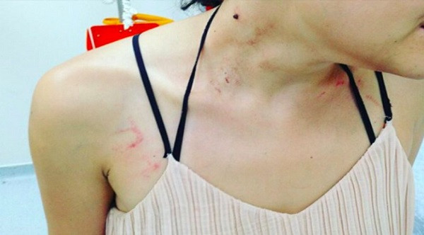 Metroda şiddet gören Gülşah Erol'un konserine erteleme - Resim: 1