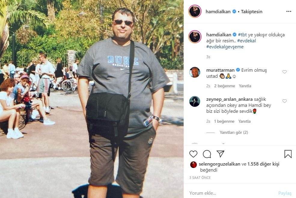 60 kilo veren Hamdi Alkan'ın değişimi! - Resim: 1