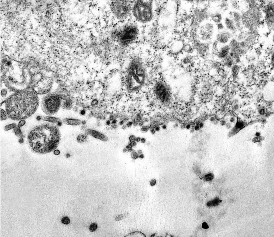 Koronavirüsün hücreye saldırı anı bilim insanlarınca görüntülendi - Resim: 1